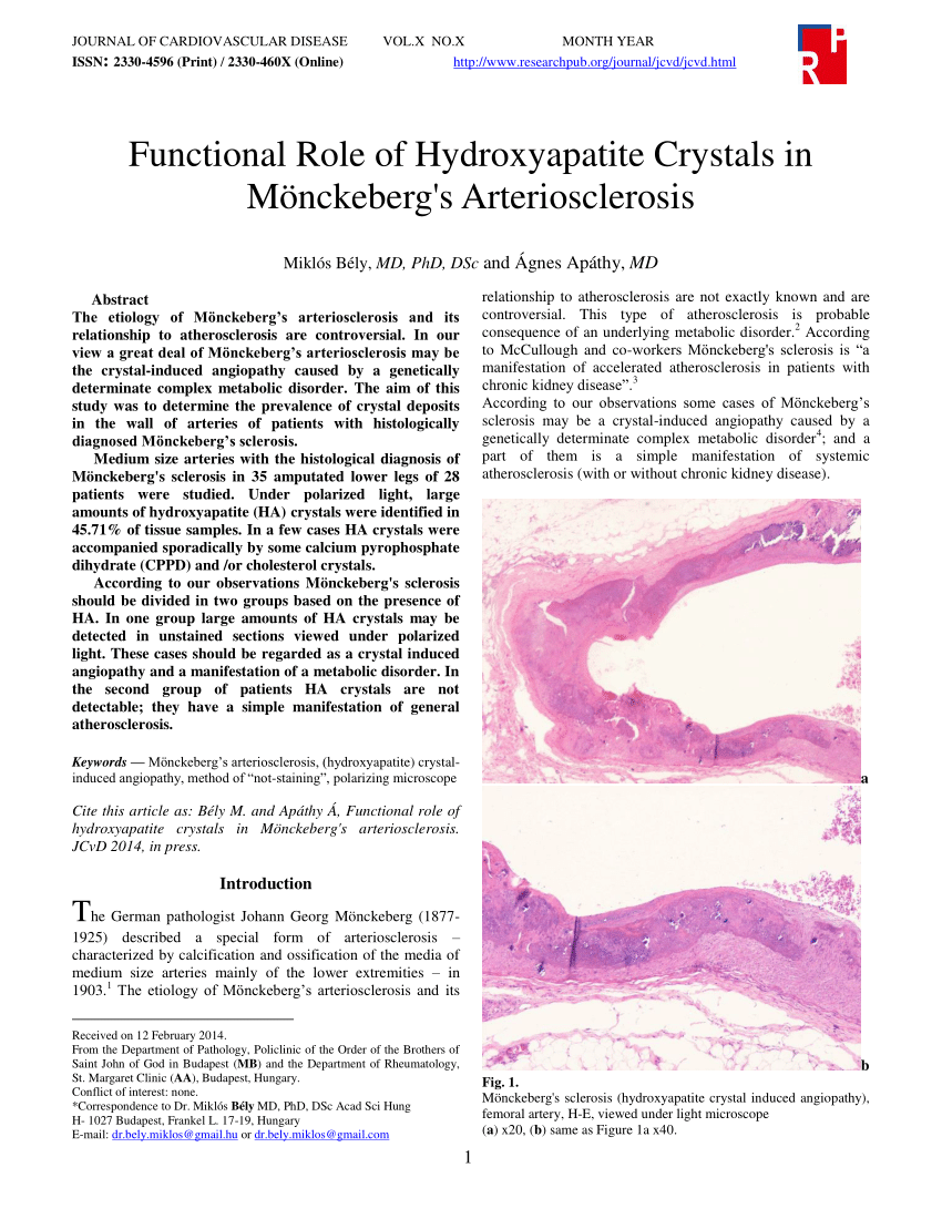 Pdf Functional Role Of Hydroxyapatite Crystals In Monckeberg S Arteriosclerosis Http Www Researchpub Org Journal Jcvd Jcvd Html