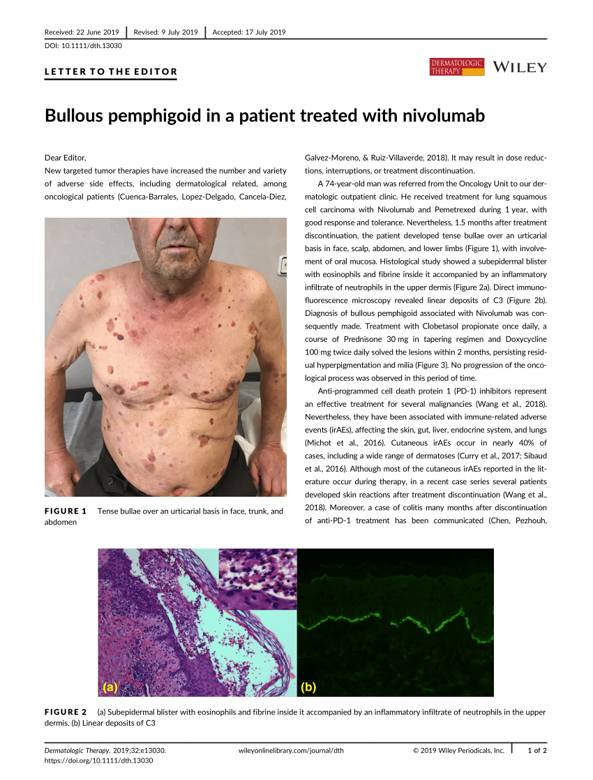 Bullous Pemphigoid In A Patient Treated With Nivolumab Request Pdf