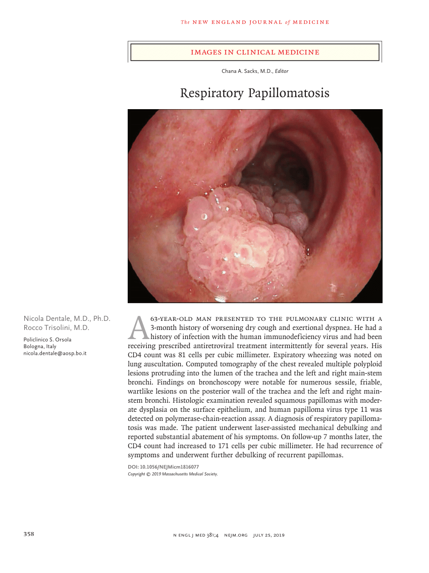 Respiratory Papillomatosis Pathogenesis Enterobius Vermicularis Quiste