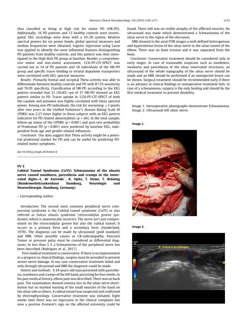 PDF FV 5 Cubital Tunnel Syndrome CuTS Schwannoma Of The Ulnaris