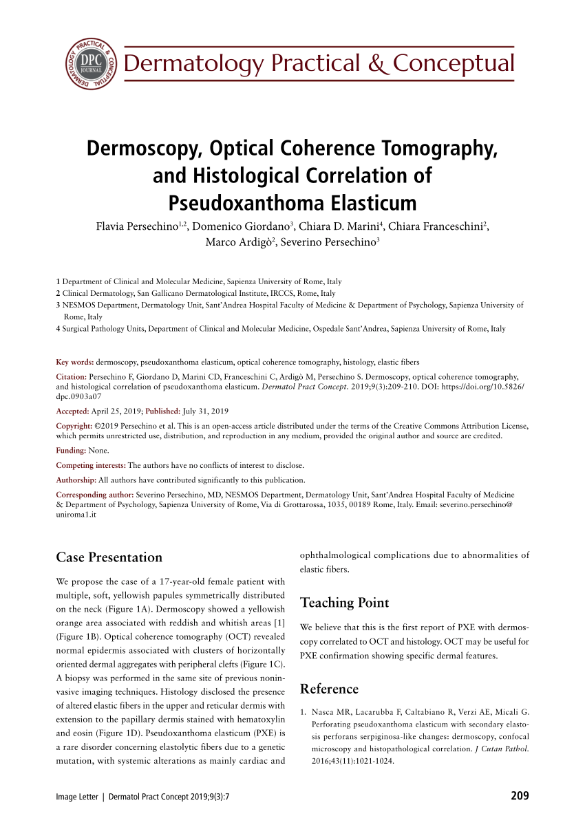 Pdf Dermoscopy Optical Coherence Tomography And Histological Correlation Of Pseudoxanthoma 4103