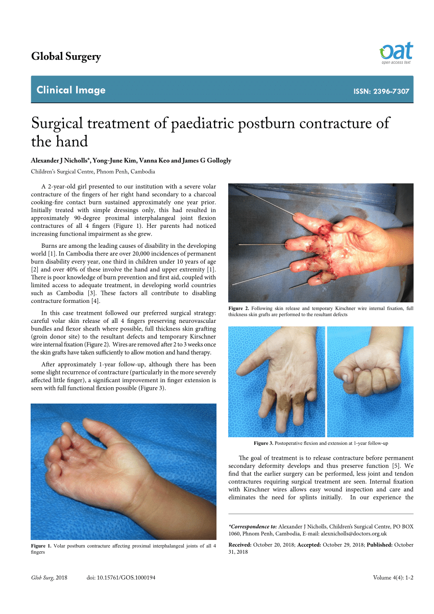 The management of postburn contractures of trunk, groin, and