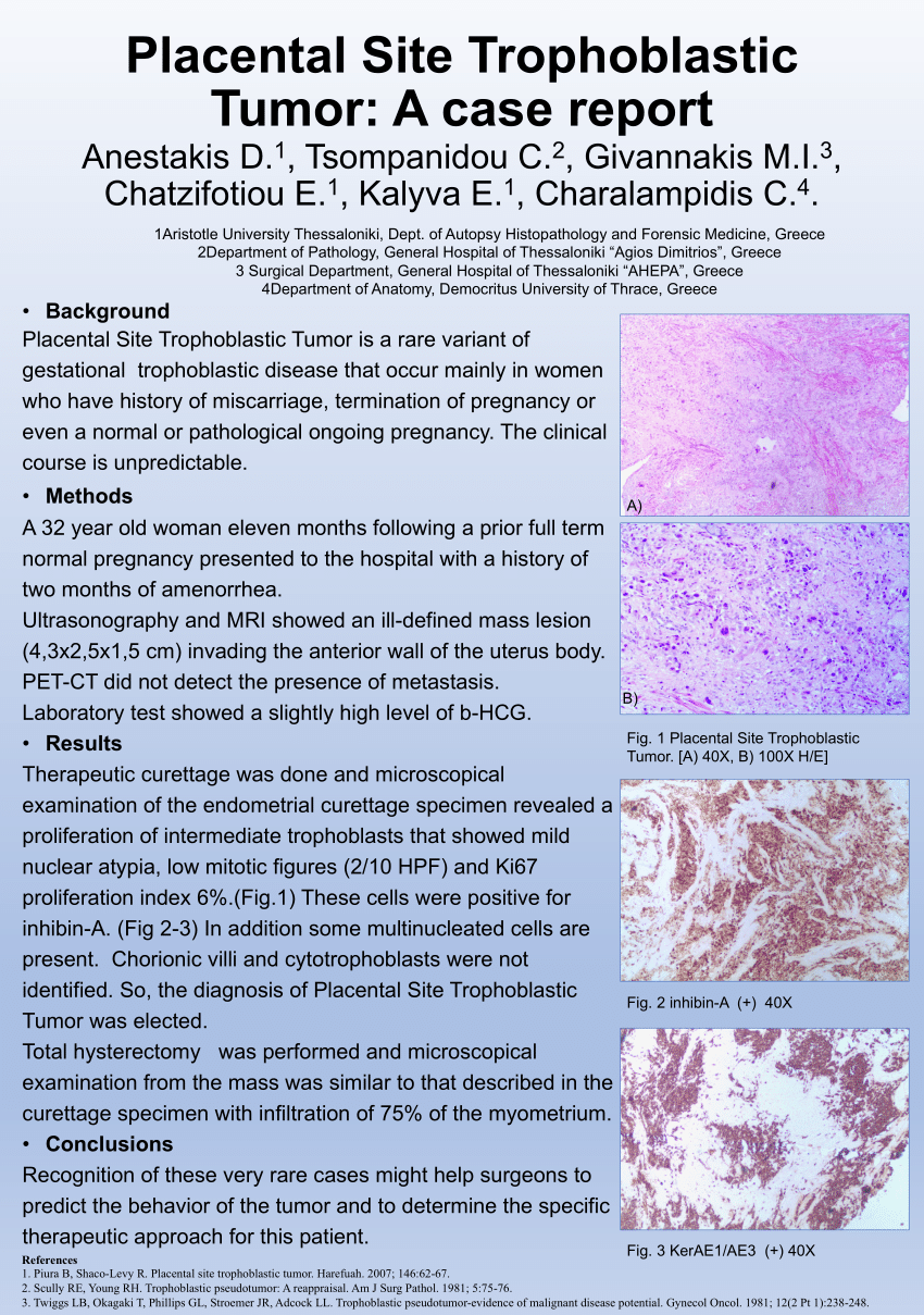 (PDF) Placental Site Trophoblastic Tumor: A case report