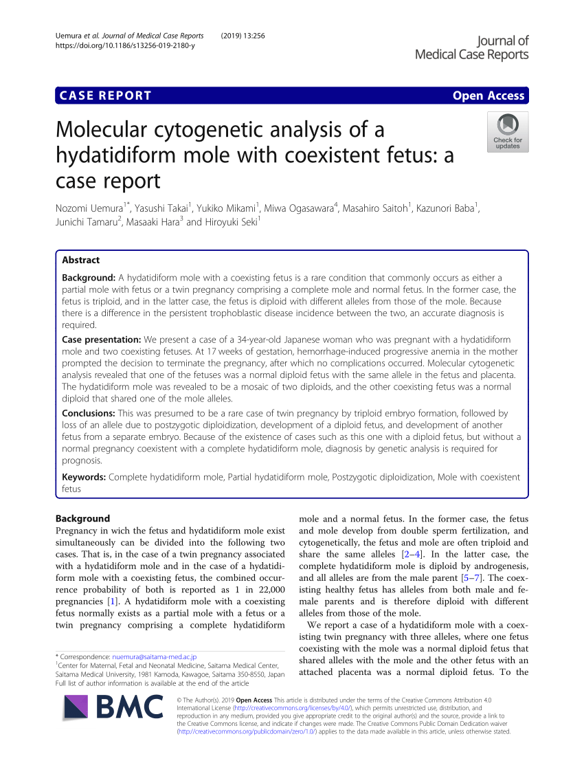 Pdf Molecular Cytogenetic Analysis Of A Hydatidiform Mole With Coexistent Fetus A Case Report 