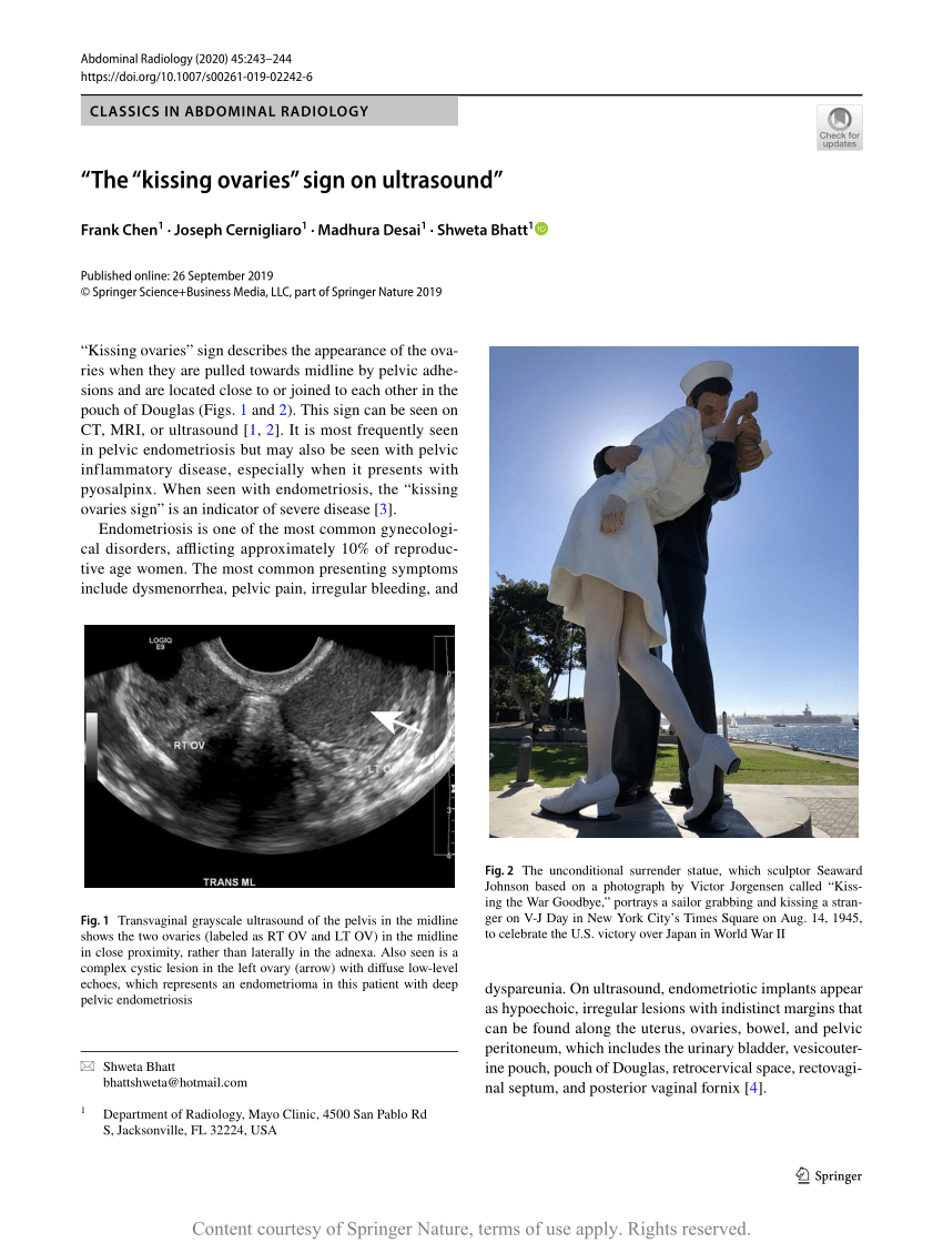 “the “kissing Ovaries” Sign On Ultrasound” Request Pdf 6585