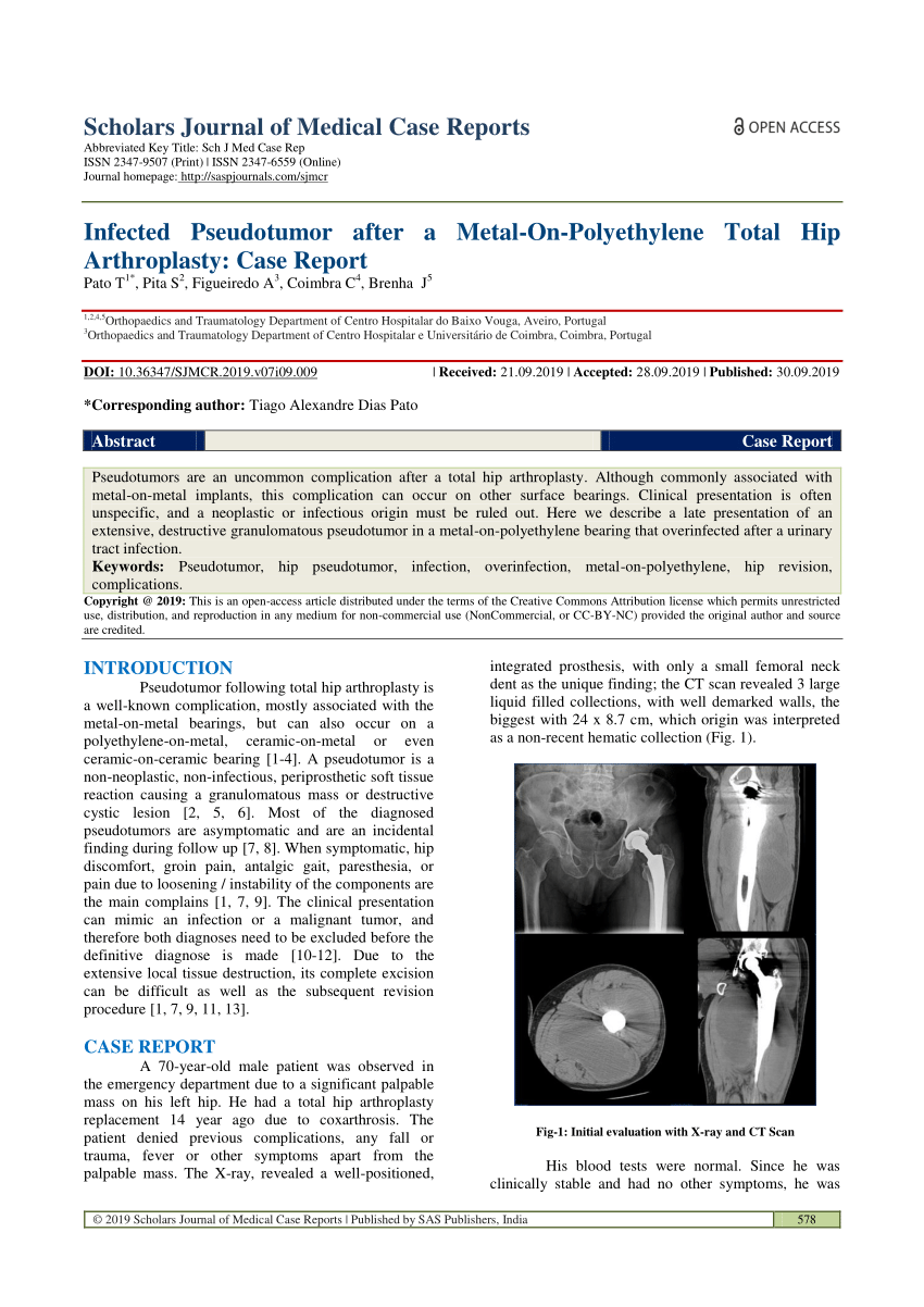 Pdf Infected Pseudotumor After A Metal On Polyethylene Total Hip Arthroplasty Case Report 5145