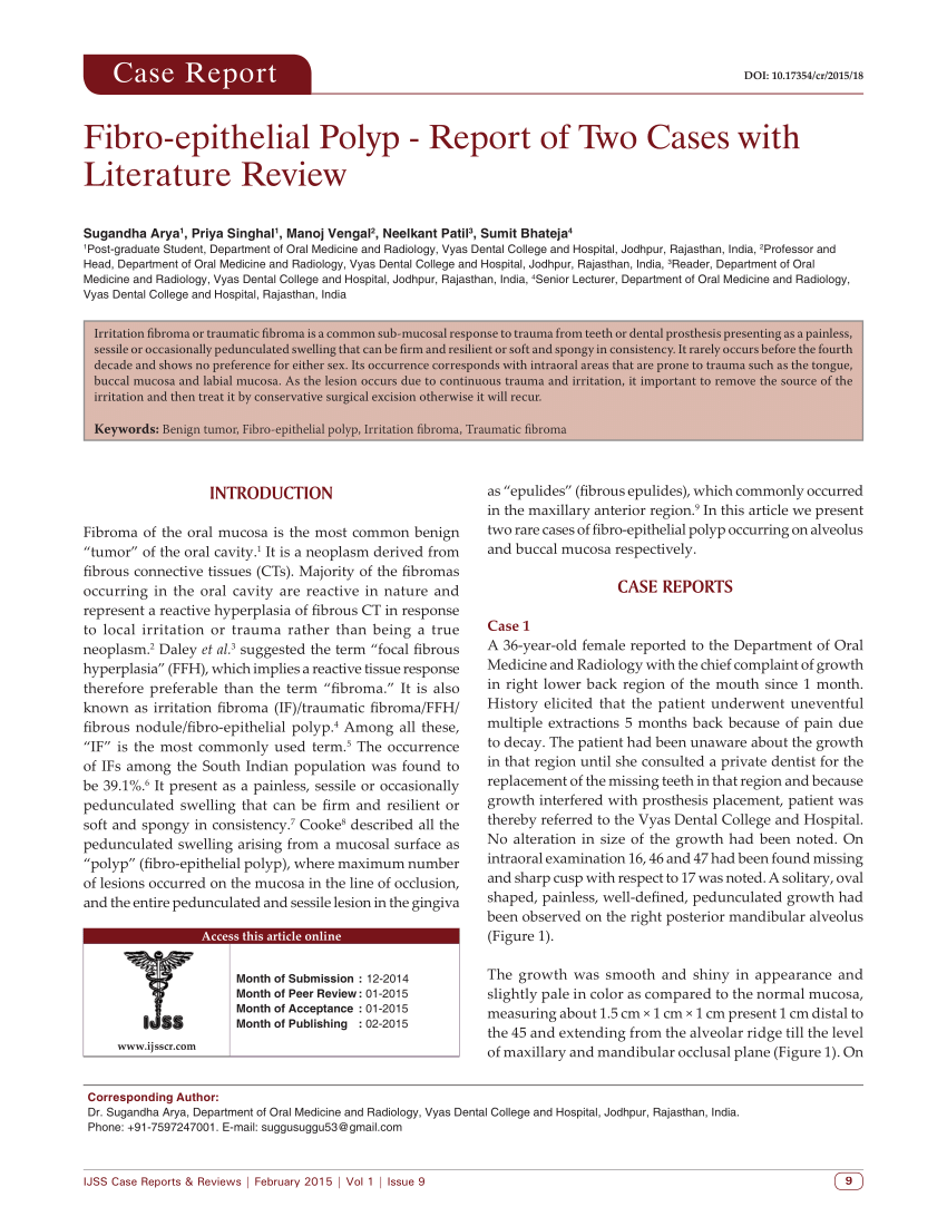 literature review of two cases