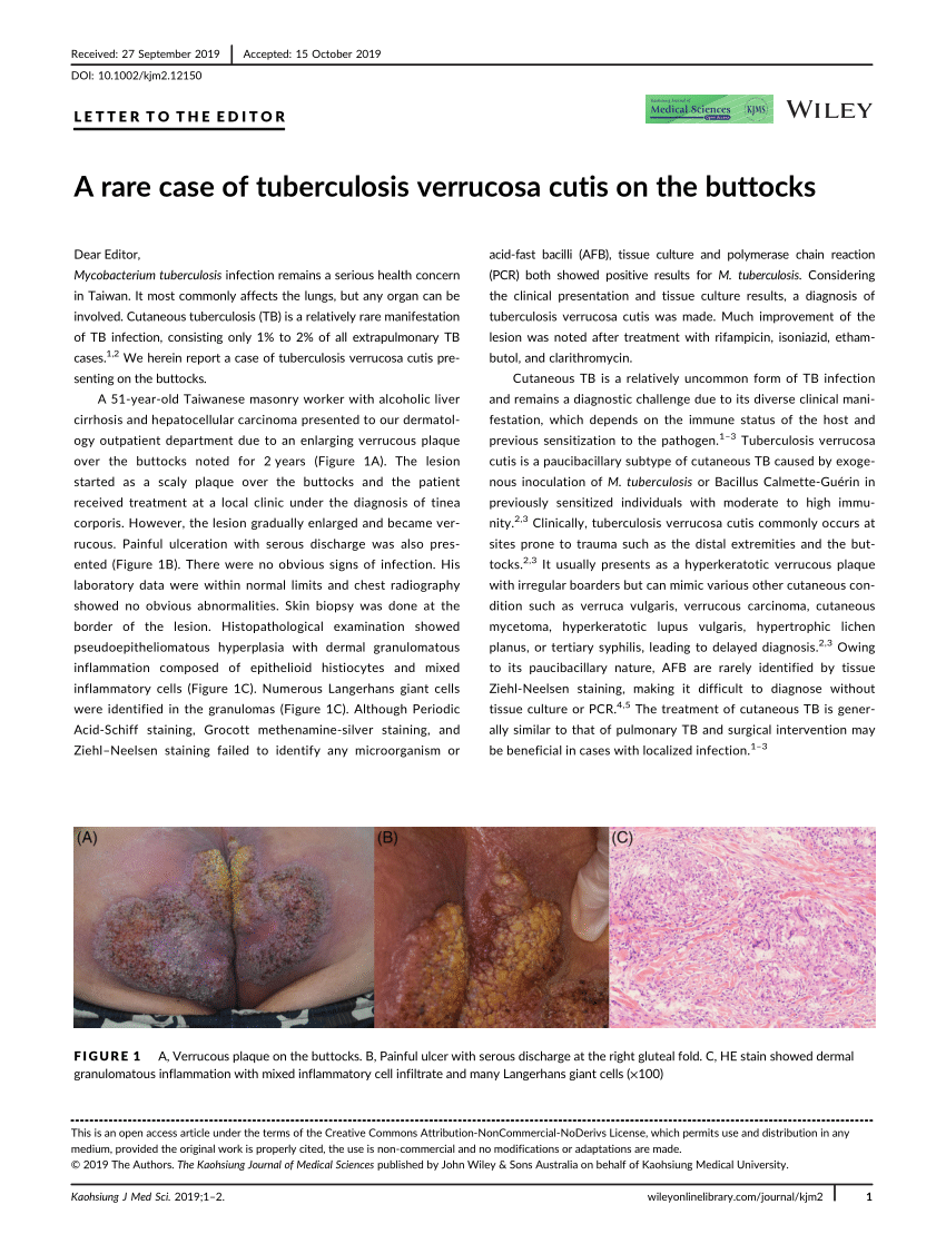 (PDF) A rare case of tuberculosis verrucosa cutis on the buttocks