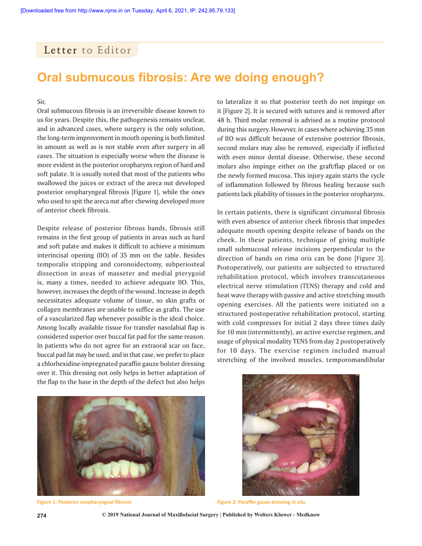 PDF Oral submucous fibrosis Are we doing enough