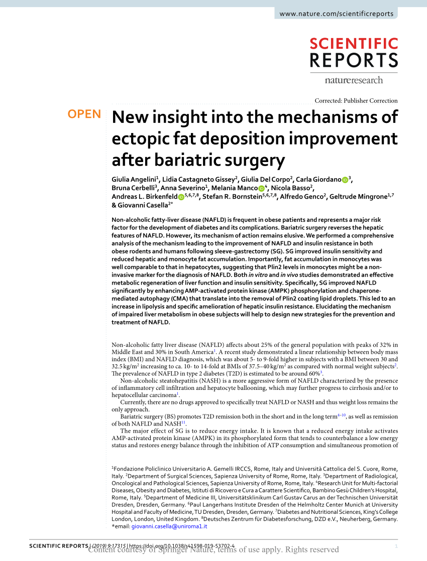 Esophagus-duodenum Gastric Bypass Surgery Improves Glucose and Lipid  Metabolism in Mice - eBioMedicine