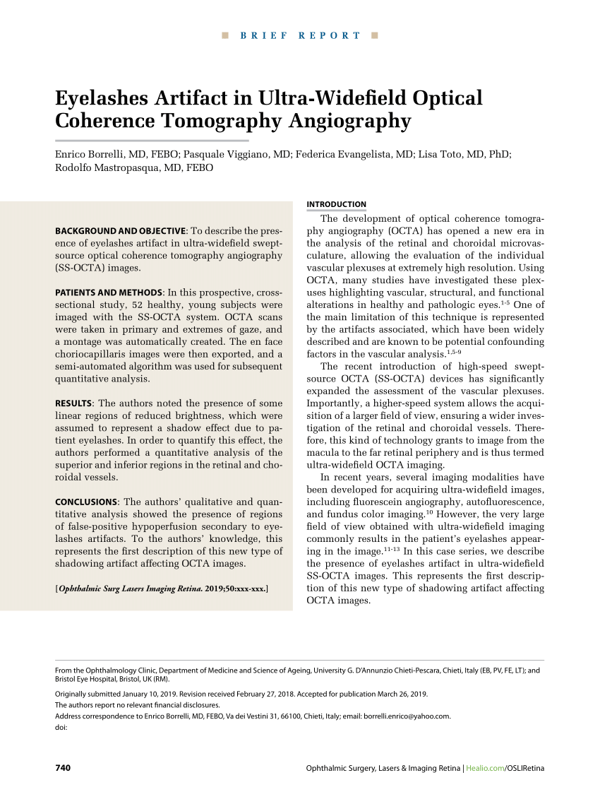 PDF Eyelashes Artifact in Ultra Widefield Optical Coherence  