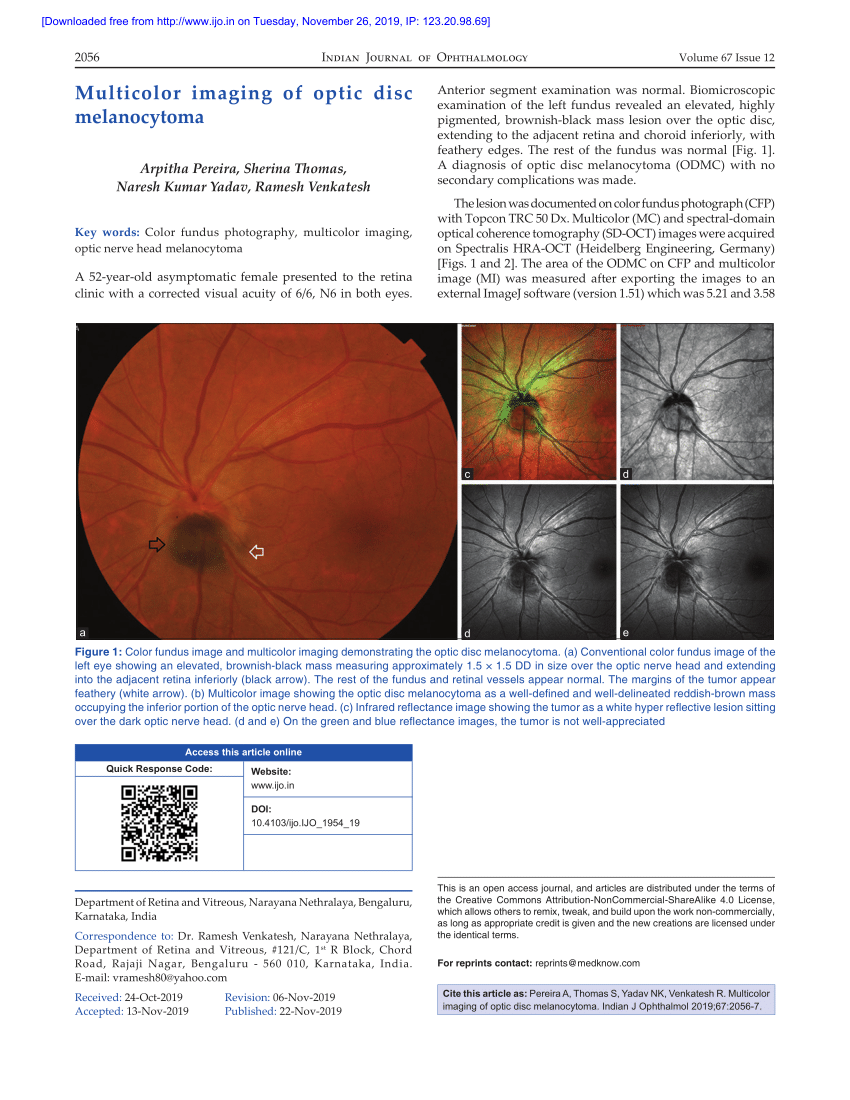 Pdf Multicolor Imaging Of Optic Disc Melanocytoma