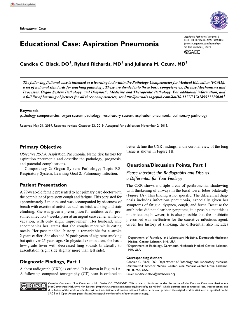 case study of aspiration pneumonia
