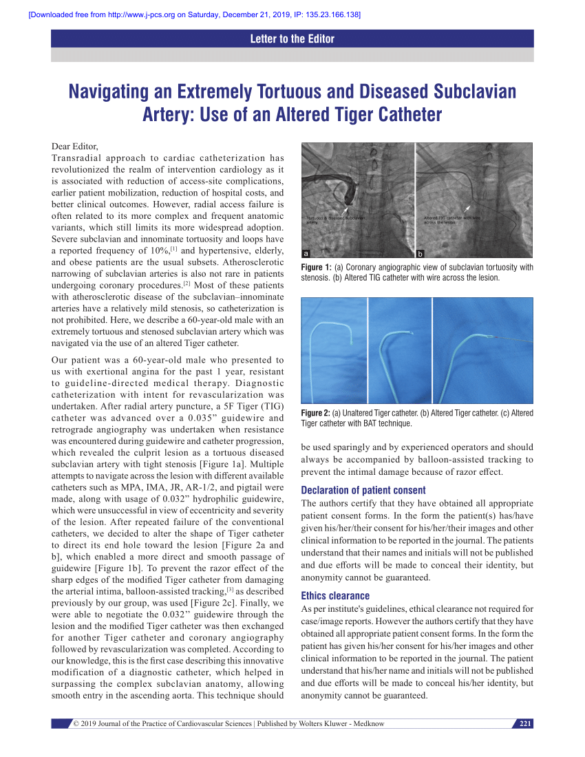 tortuous guideliner support catheter techniques
