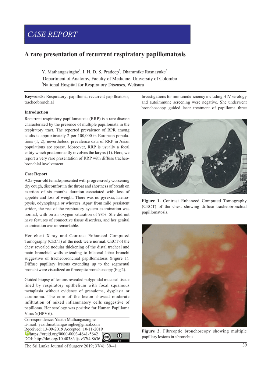 Papillomatosis rare. Respiratory papillomatosis how rare