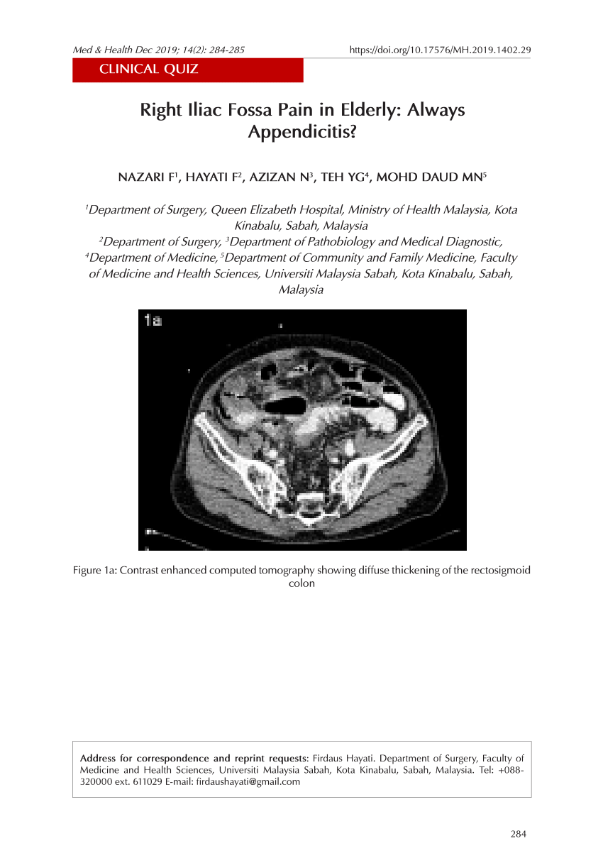 Right Iliac Fossa Pain In Elderly