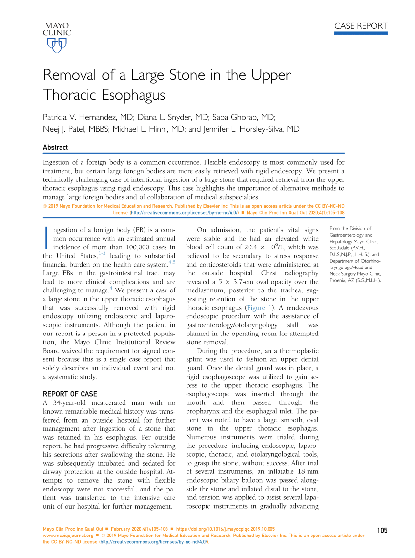 Pdf Removal Of A Large Stone In The Upper Thoracic Esophagus