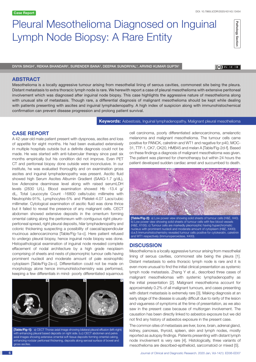 peritoneal mesothelioma and serous carcinomas