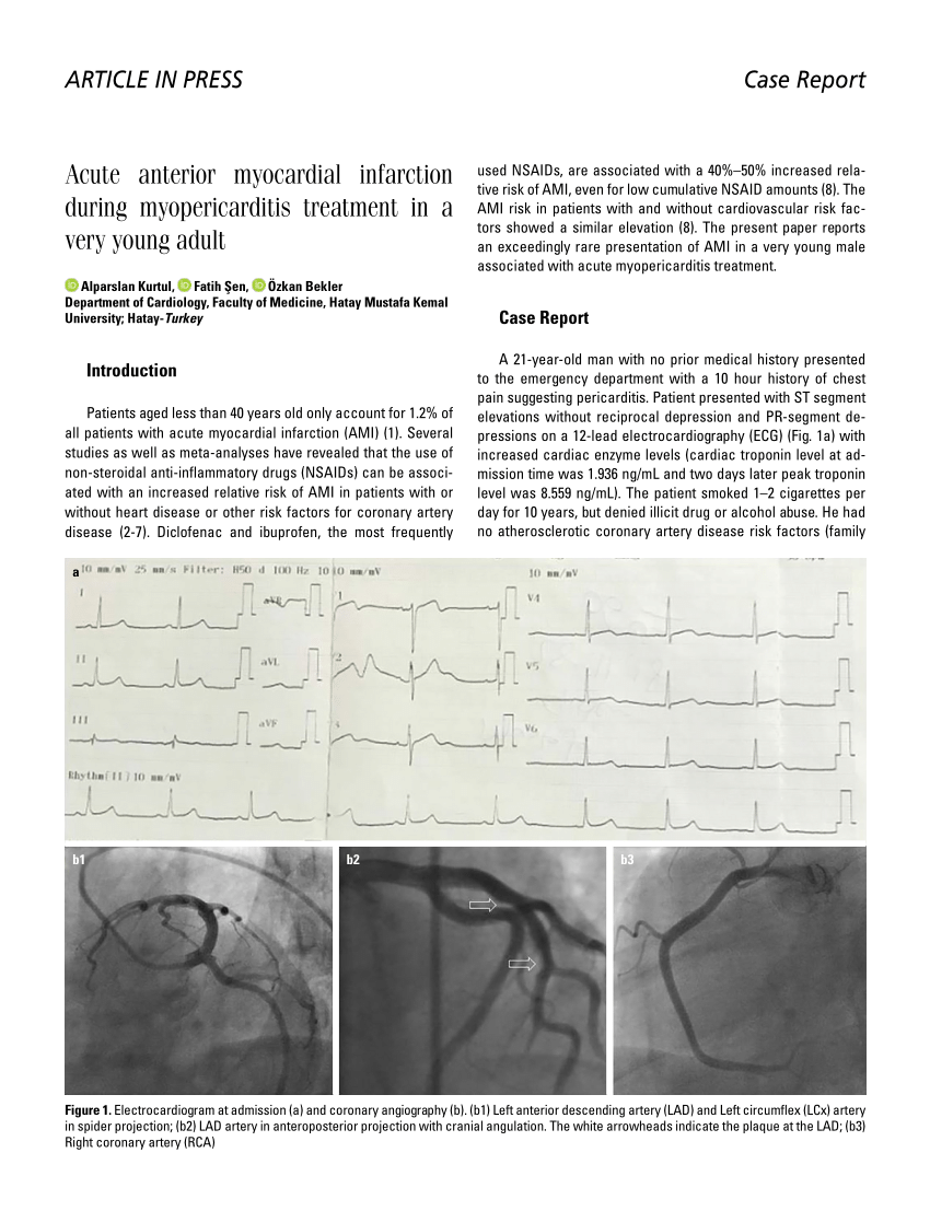Pdf Case Report A Rare Case Of Acute Anterior Myocardial Infarction Hot Sex Picture 