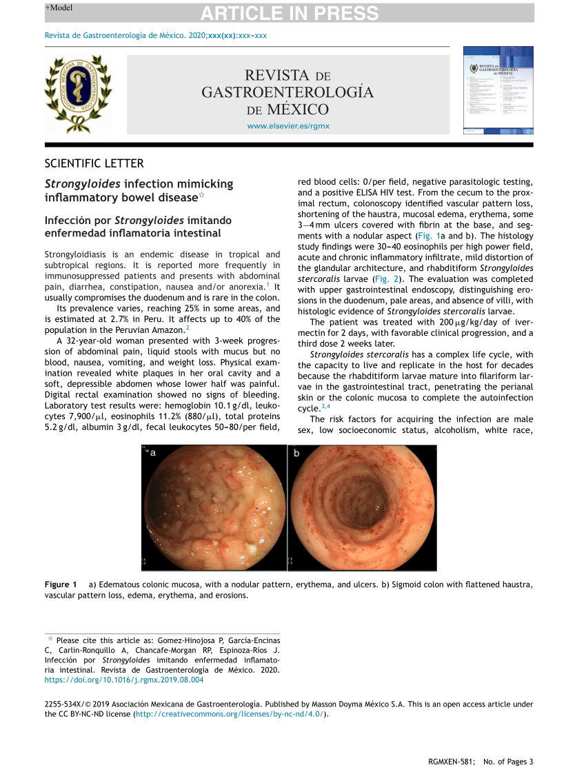 PDF Strongyloides infection mimicking inflammatory bowel disease 