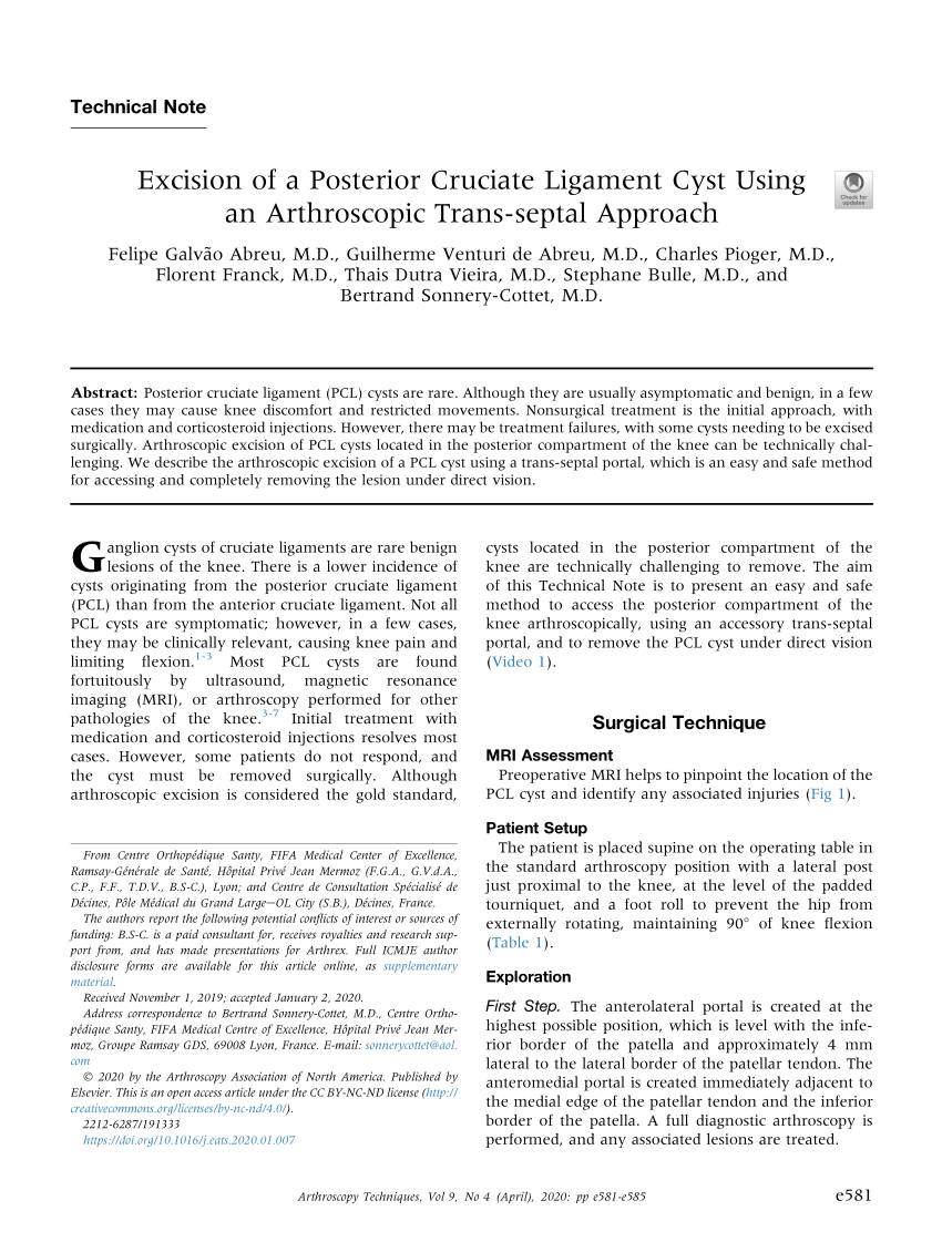 Pdf Excision Of A Posterior Cruciate Ligament Cyst Using An Arthroscopic Trans Septal Approach 2750