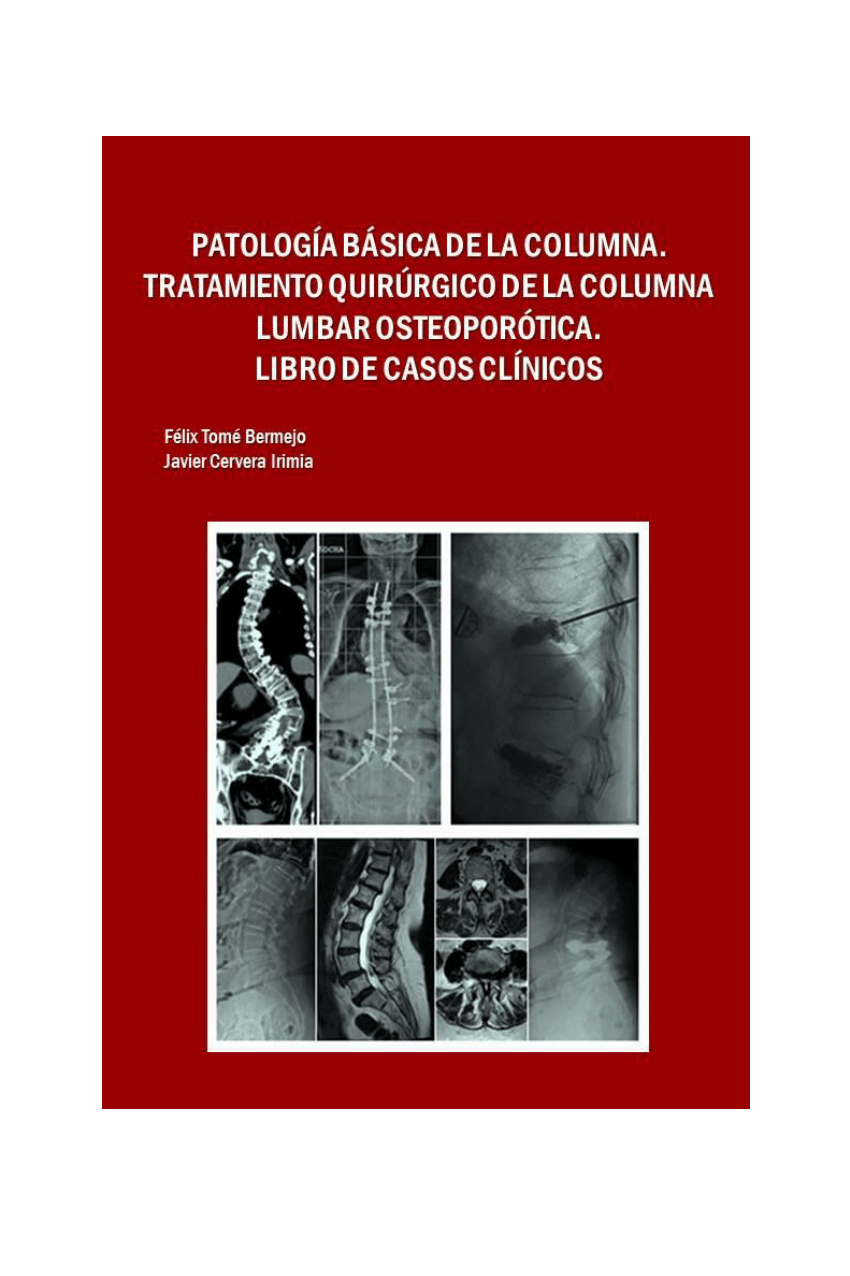 Radiografía anteroposterior y lateral de columna lumbar