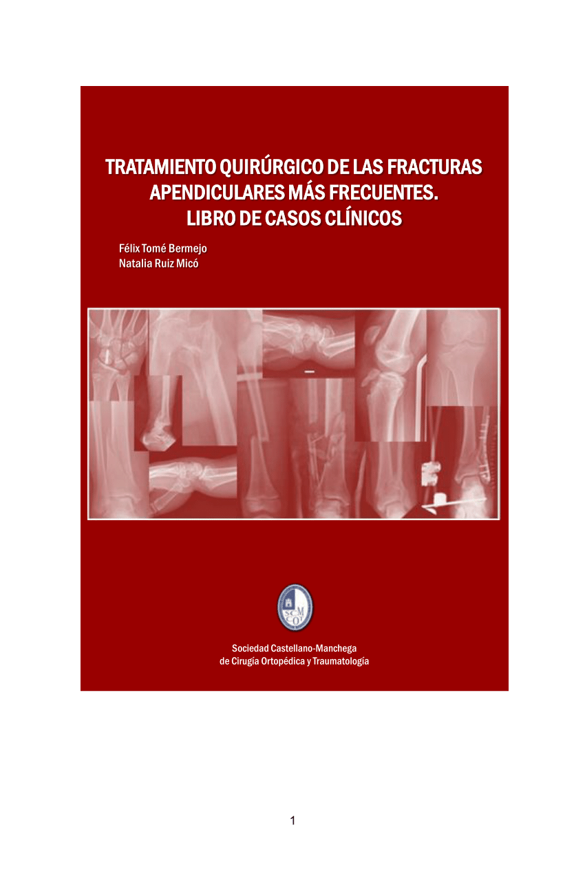 Solución para la artrosis de manos - Dr. Félix López - Traumatólogo en  Madrid
