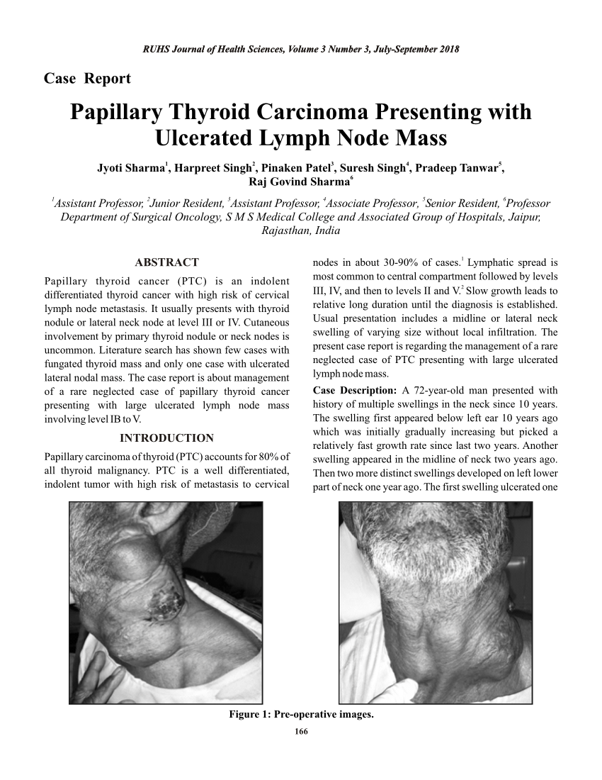 Papillary Thyroid Carcinoma Medicine Notes Thorax Ele