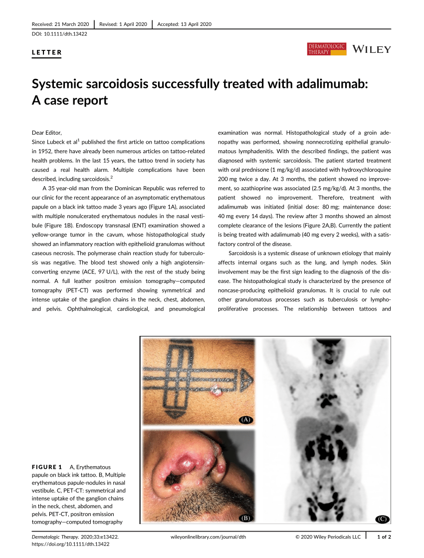 Systemic Sarcoidosis Successfully Treated With Adalimumab A Case Report Request Pdf 