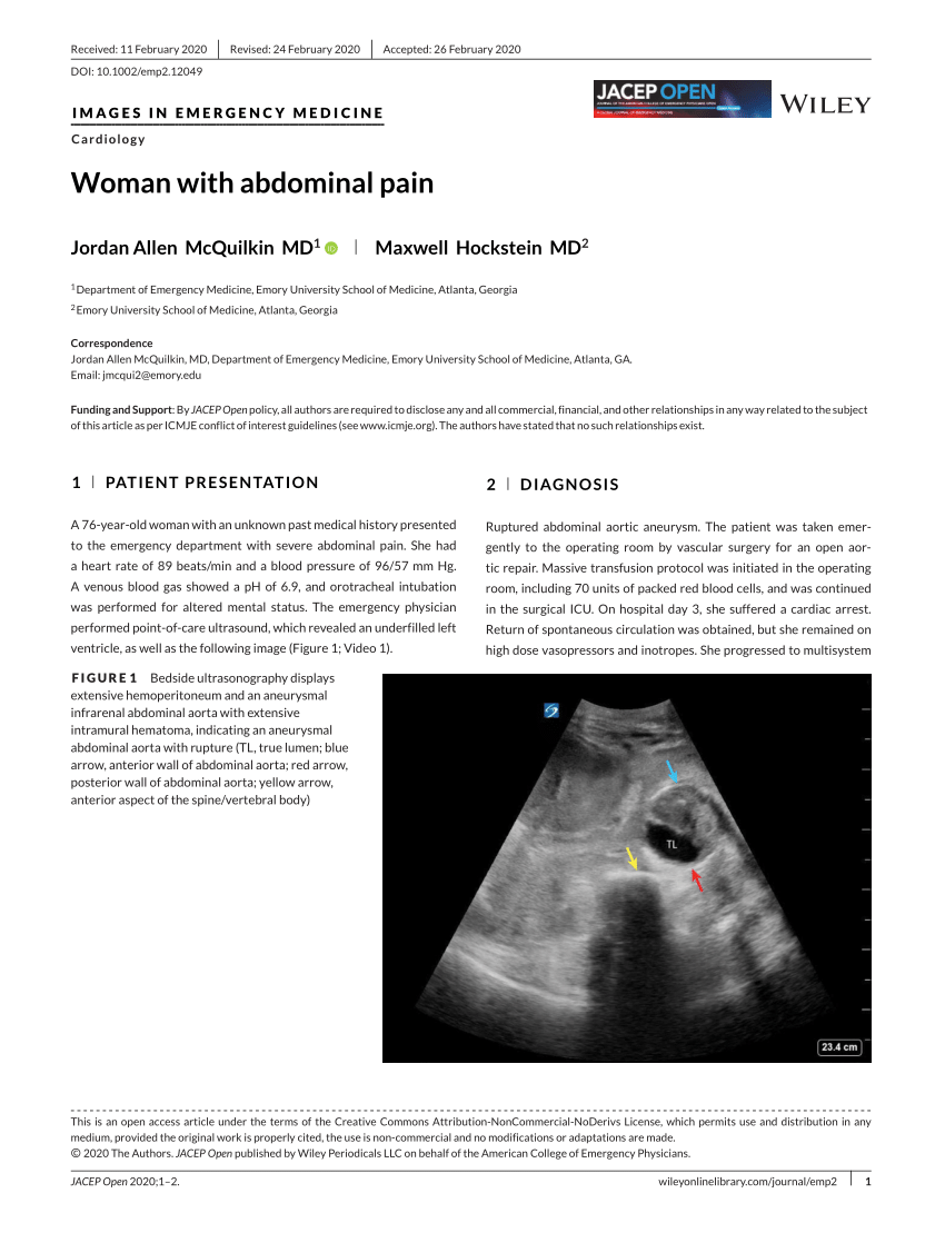 pdf-woman-with-abdominal-pain