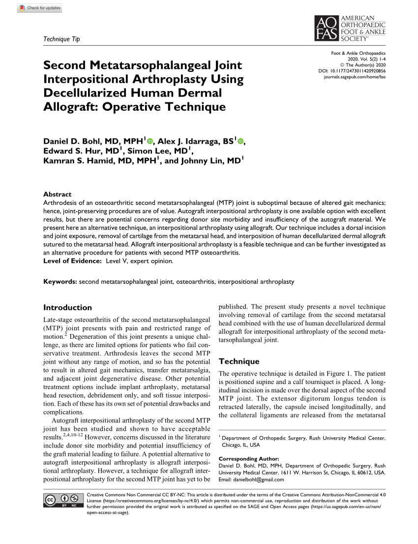 Pdf Second Metatarsophalangeal Joint Interpositional Arthroplasty Using Decellularized Human Dermal Allograft Operative Technique