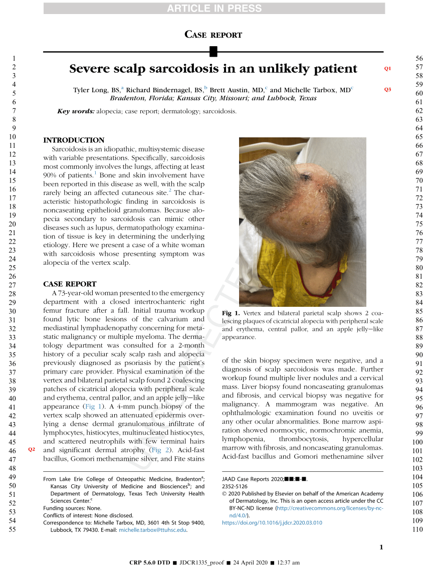 (PDF) Severe scalp sarcoidosis in an unlikely patient