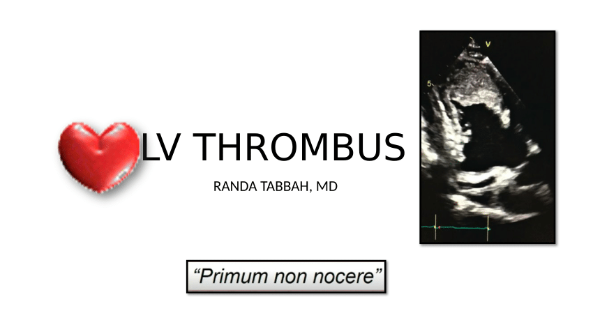 (PDF) lv thrombus