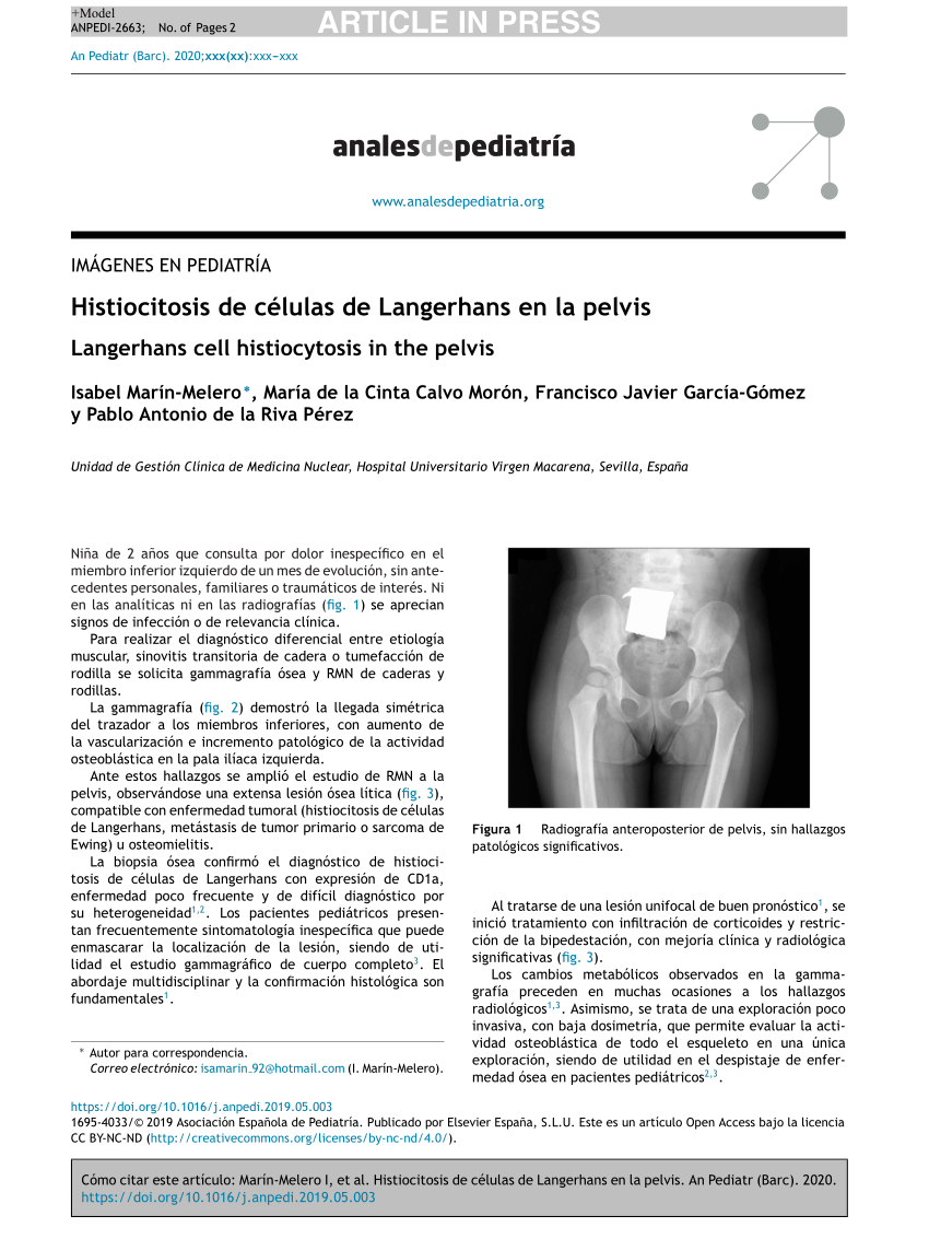 PDF Histiocitosis de células de Langerhans en la pelvis 