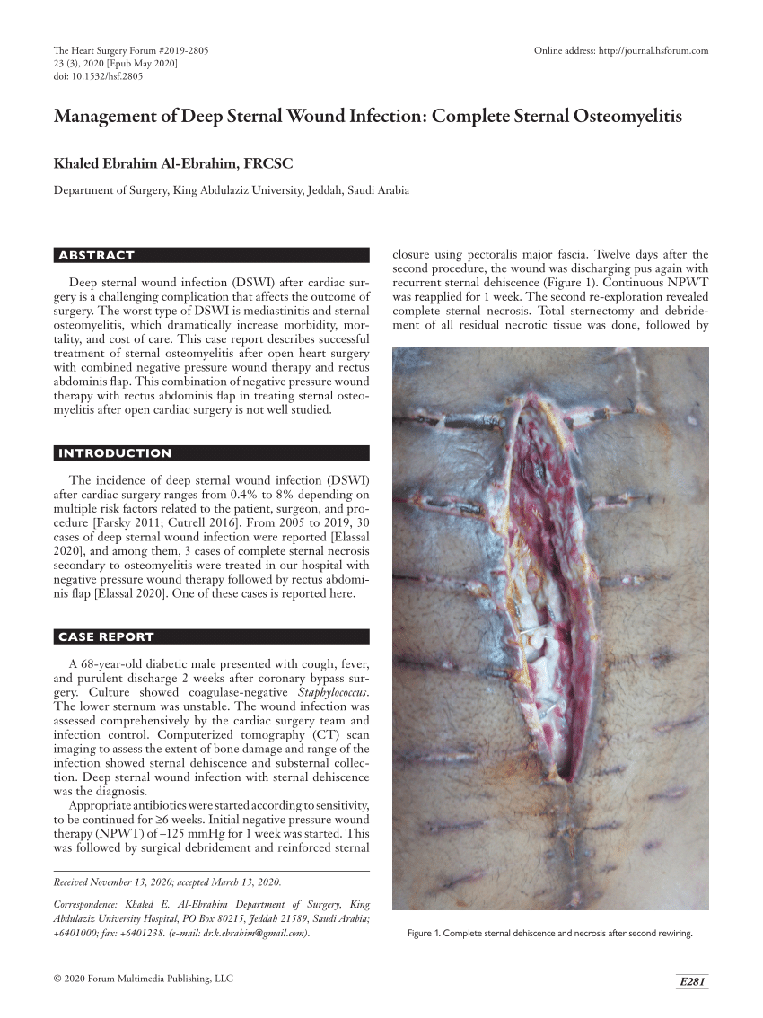 (PDF) Management of Deep Sternal Wound Infection