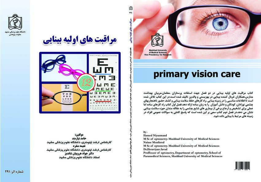 what is assignment vision care