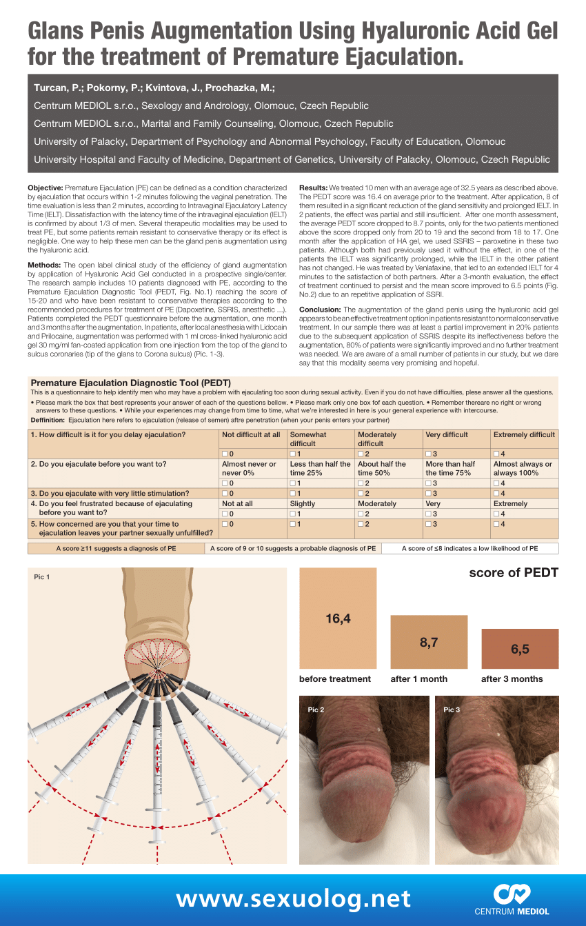 PDF P 02 23 Glans Penis Augmentation Using Hyaluronic Acid Gel