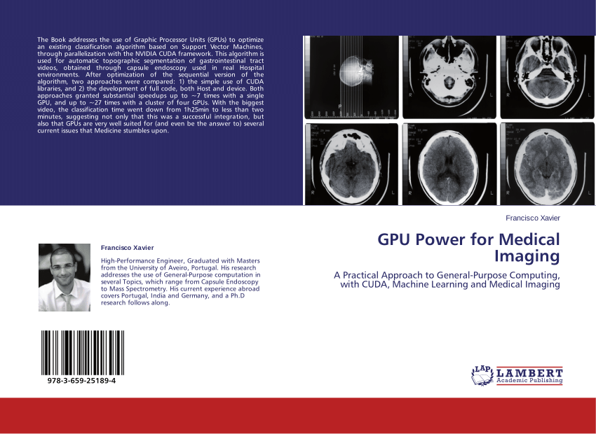 (PDF) GPU Power for Medical Imaging: A Practical Approach to General ...