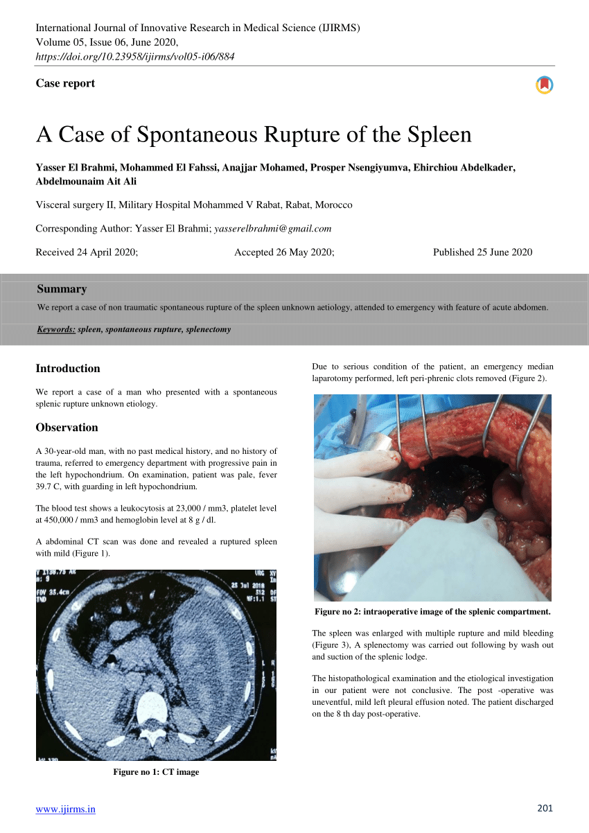 Pdf A Case Of Spontaneous Rupture Of The Spleen