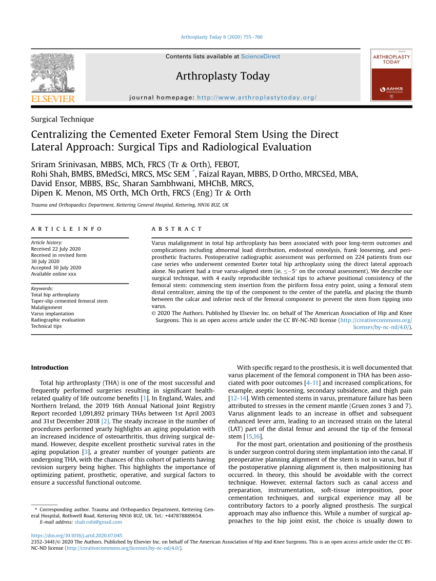 Total Hip replacement(posterior approach): Exeter femoral stem and