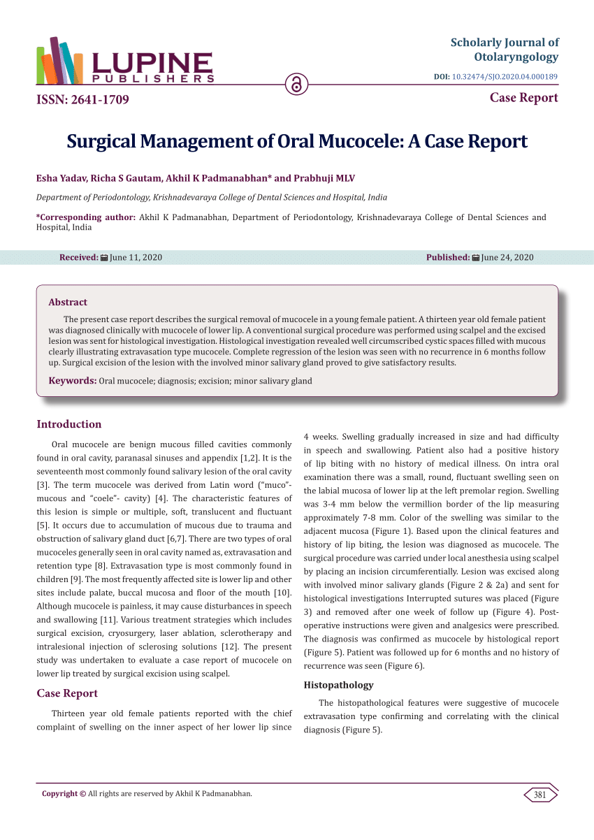 Pdf Surgical Management Of Oral Mucocele A Case Report