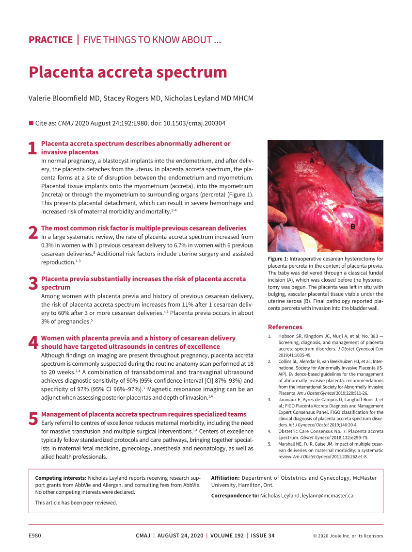 impact-of-placenta-previa-with-placenta-accreta-spectrum-disorder-on