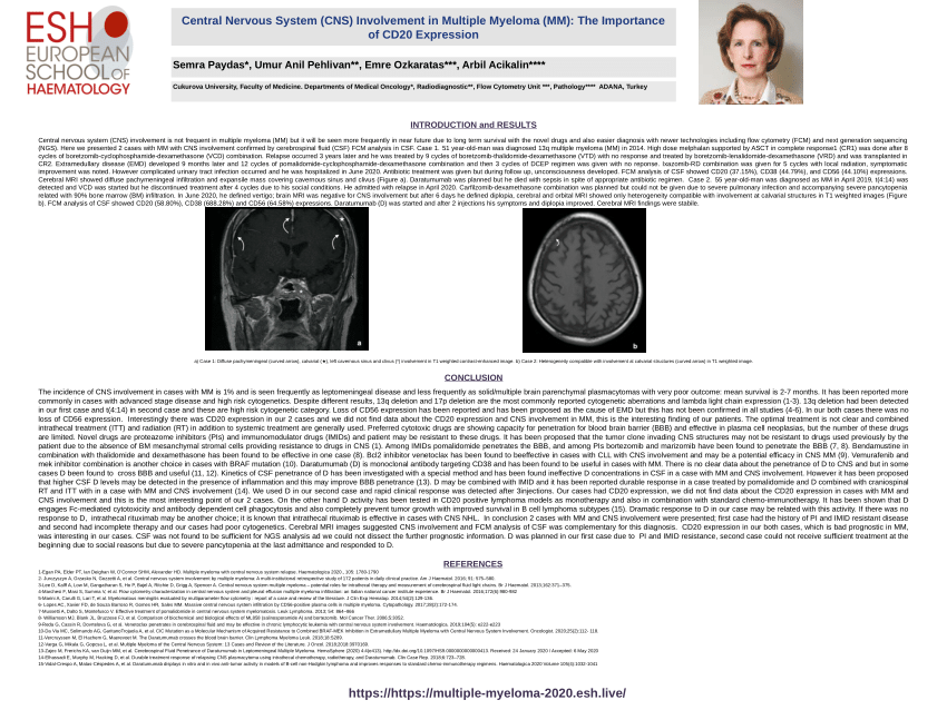 Pdf Central Nervous System Cns Involvement In Multiple Myeloma Mm The Importance Of Cd20 