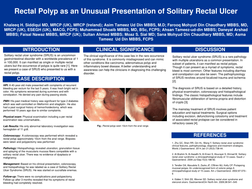 Pdf Rectal Polyp As An Unusual Presentation Of Solitary Rectal Ulcer 