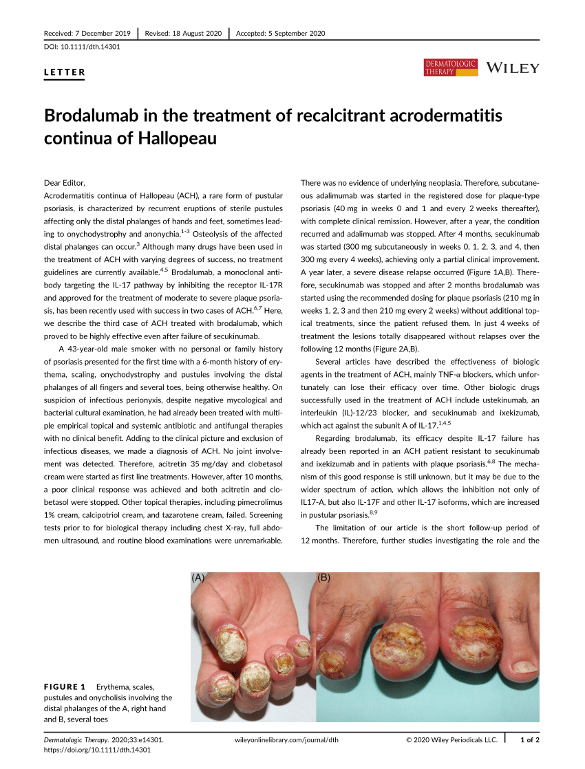 Brodalumab In The Treatment Of Recalcitrant Acrodermatitis Continua Of