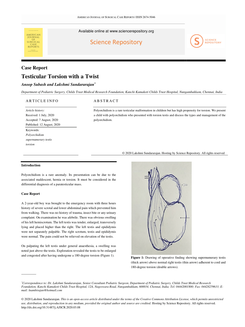 (PDF) Testicular Torsion with a Twist