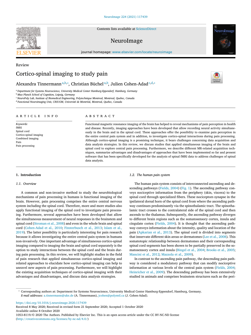 Corticostriatal circuits in the transition to chronic back pain: The  predictive role of reward learning - ScienceDirect