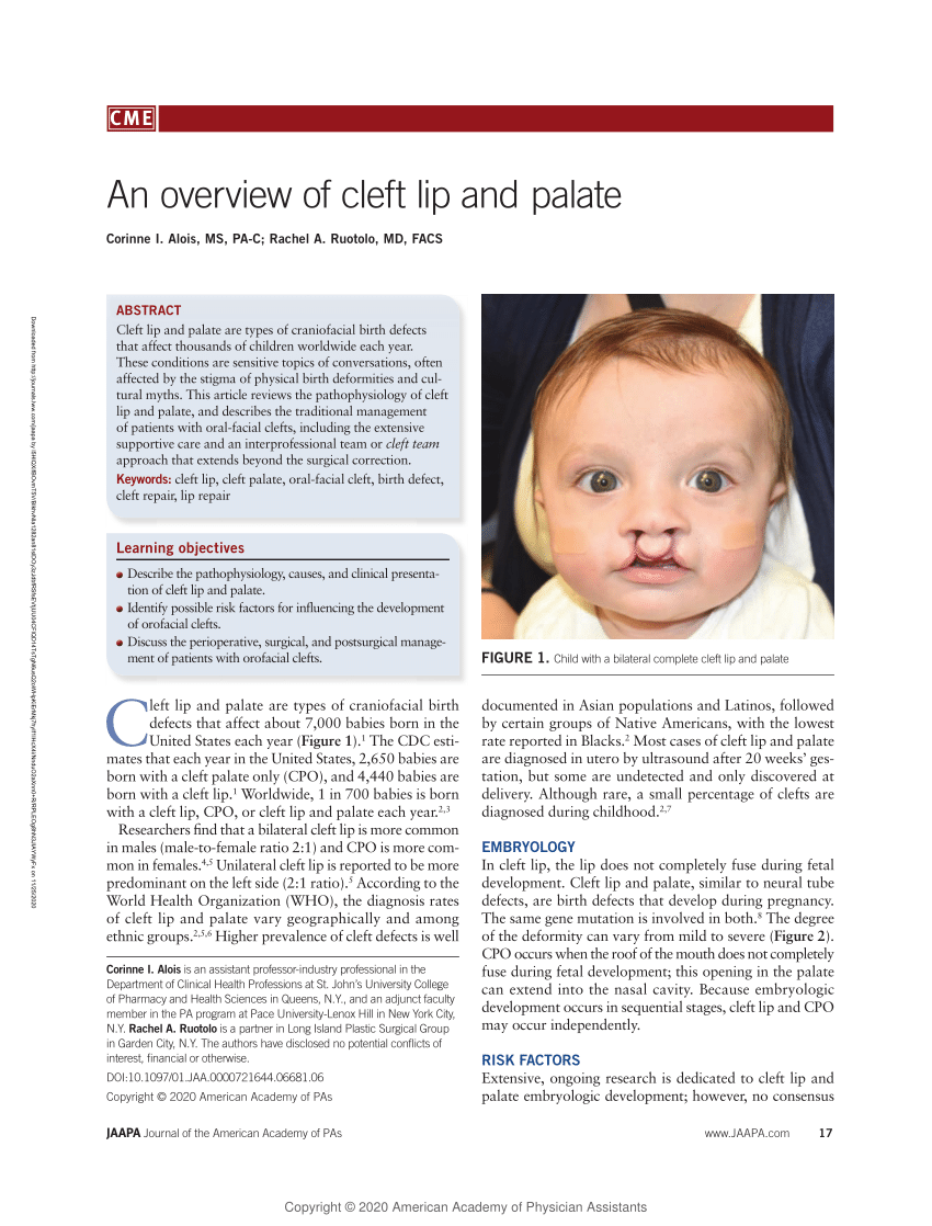 case study 101 cleft palate