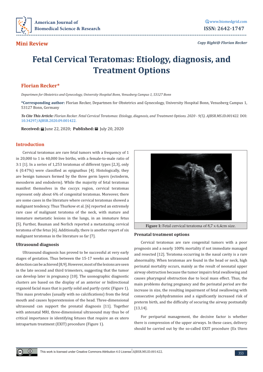 Pdf Fetal Cervical Teratomas Etiology Diagnosis And Treatment Options