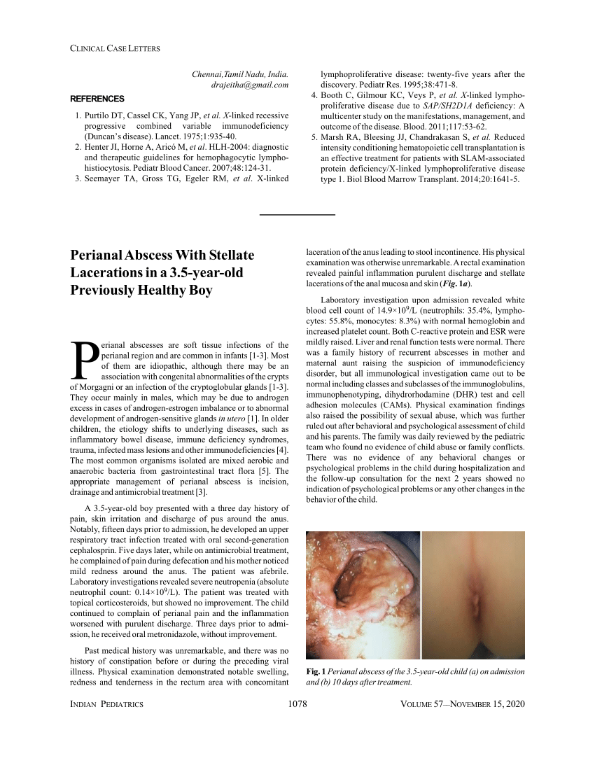 Pdf Perianal Abscess With Stellate Lacerations In A 3 5 Year Old